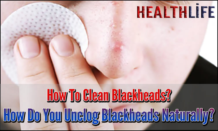 How To Clean Blackheads