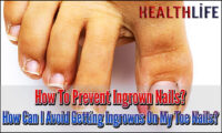 How To Prevent Ingrown Nails