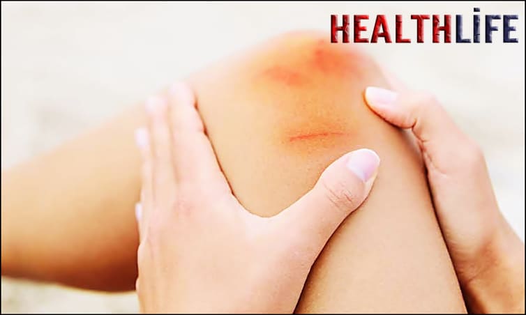 What Are The Most Likely Causes Of Internal Bleeding