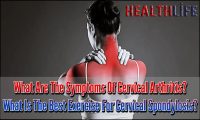 What Are The Symptoms Of Cervical Arthritis