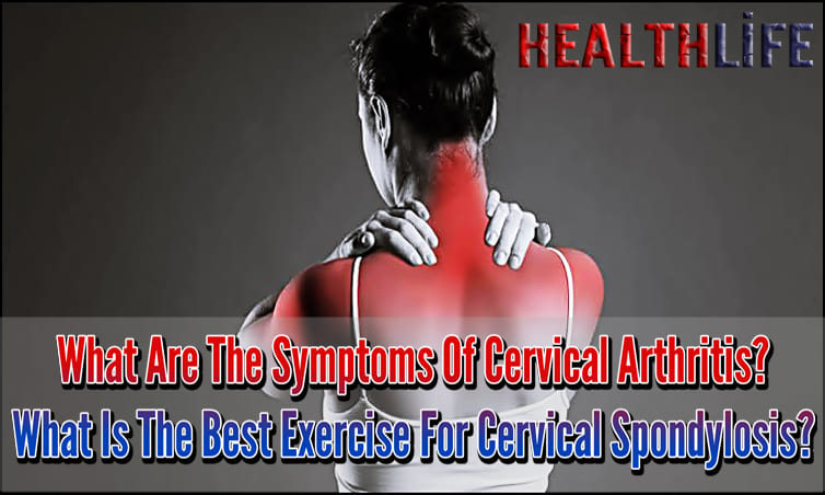 What Are The Symptoms Of Cervical Arthritis