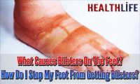 What Causes Blisters On The Feet