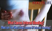 What Causes Internal Bleeding