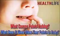 What Causes Palate Itching