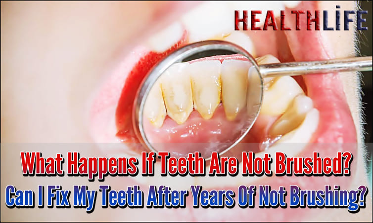 What Happens If Teeth Are Not Brushed