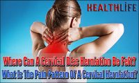 Where Can A Cervical Disc Herniation Be Felt