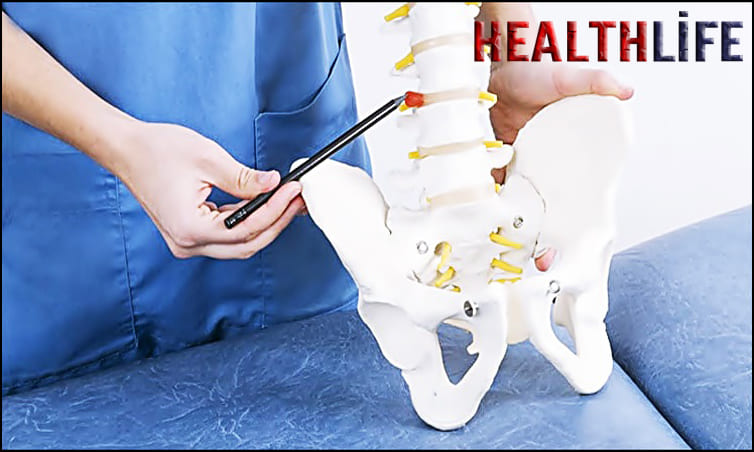How Long Is Bed Rest After Herniated Disc Surgery