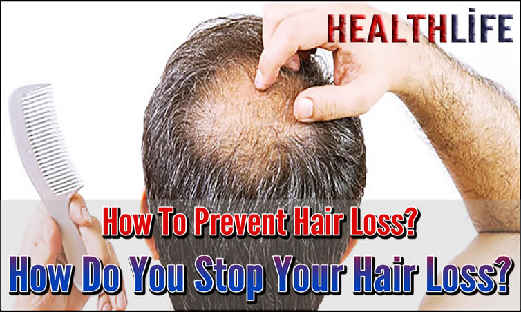 How To Prevent Hair Loss
