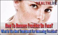 How To Remove Freckles On Face