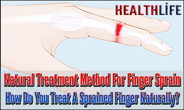 Natural Treatment Method For Finger Sprain