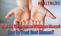 What Are The Symptoms Of Hafakan Disease