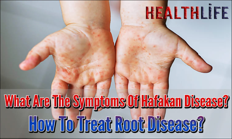 What Are The Symptoms Of Hafakan Disease