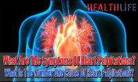 What Are The Symptoms Of Heart Palpitations