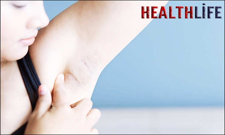 What Causes Armpit Gland Pain