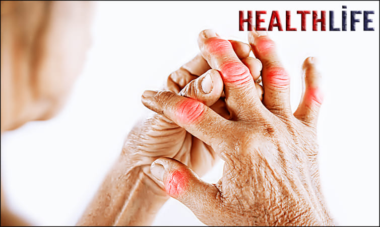 What Is The Best Way To Relieve Joint Pain