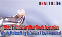 What To Consider After Tooth Extraction