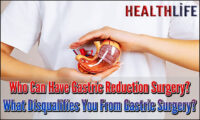 Who Can Have Gastric Reduction Surgery