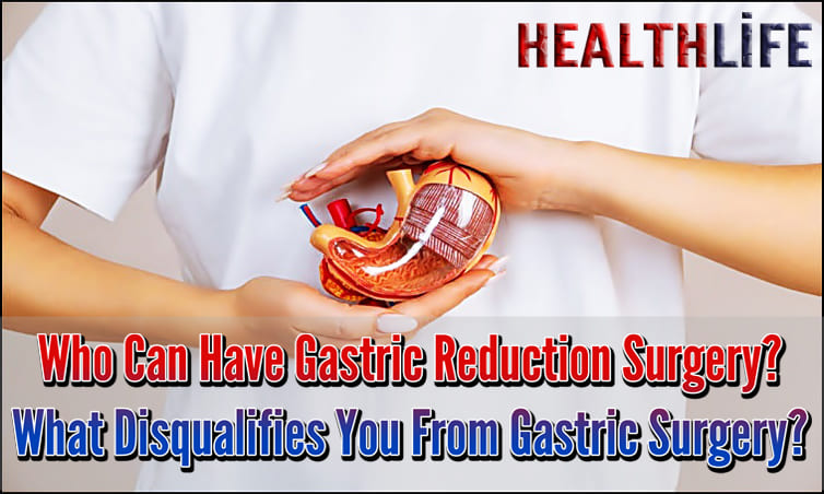 Who Can Have Gastric Reduction Surgery