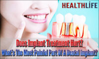 Does Implant Treatment Hurt