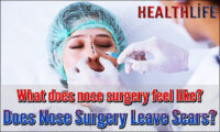 Does Nose Surgery Hurt