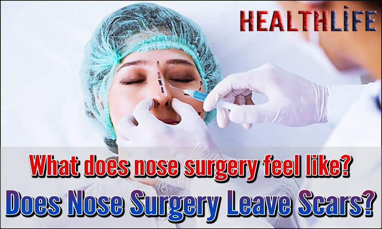 Does Nose Surgery Hurt