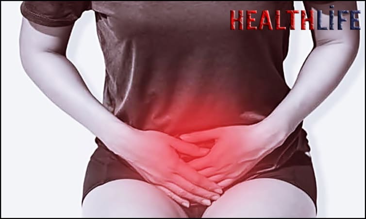 Does Pelvic Congestion Affect Pregnancy