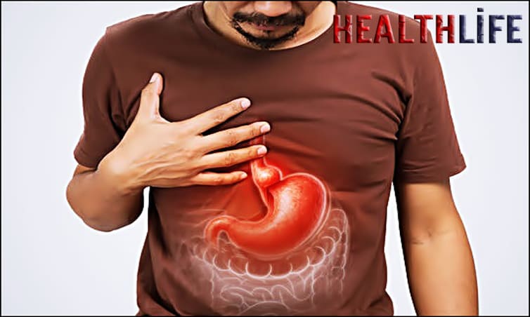 How Do You Get Rid Of Acid Reflux In Your Throat