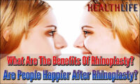 What Are The Benefits Of Rhinoplasty