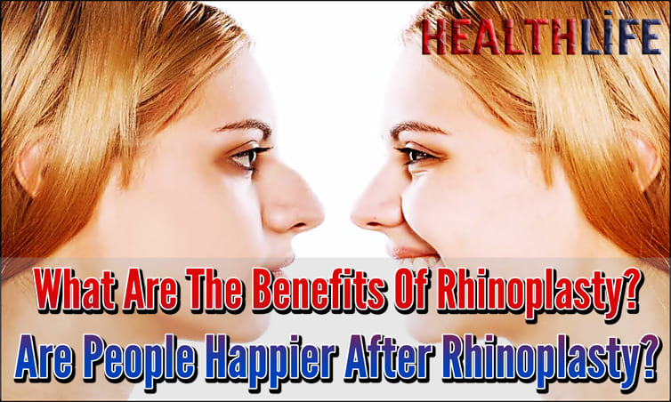 What Are The Benefits Of Rhinoplasty