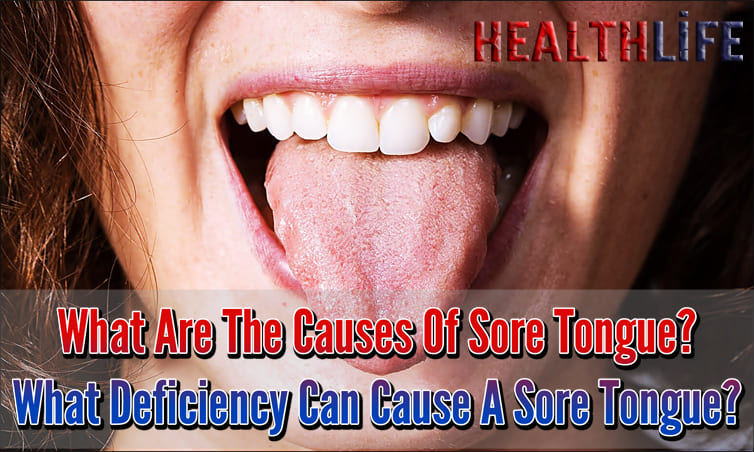 What Are The Causes Of Sore Tongue