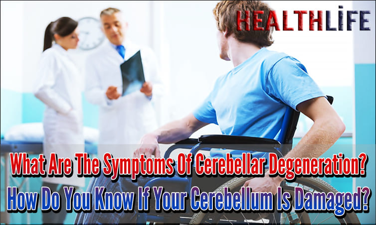 What Are The Symptoms Of Cerebellar Degeneration