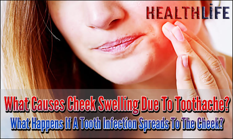 What Causes Cheek Swelling Due To Toothache