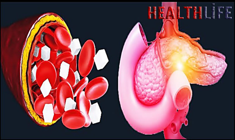 What Causes Hypoglycemia In Pregnancy