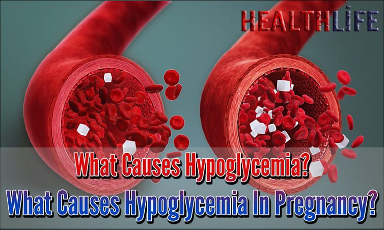 What Causes Hypoglycemia