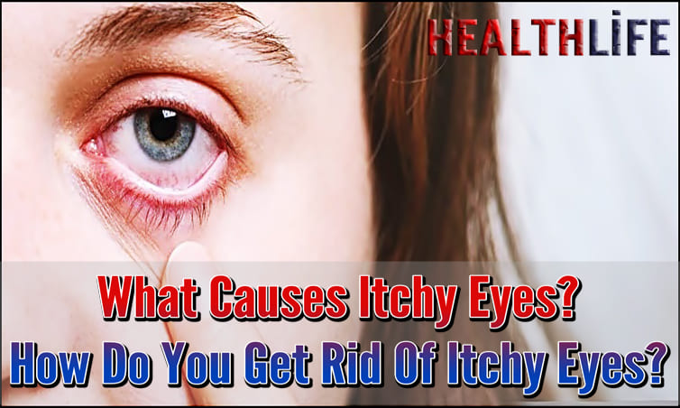 What Causes Itchy Eyes