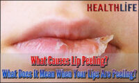 What Causes Lip Peeling