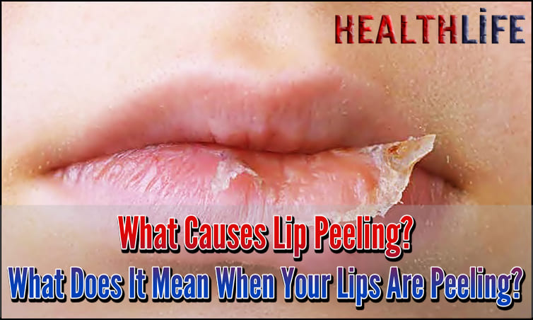 What Causes Lip Peeling
