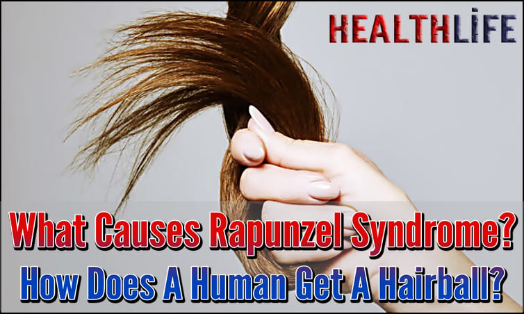 What Causes Rapunzel Syndrome