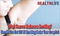 What Causes Underarm Swelling