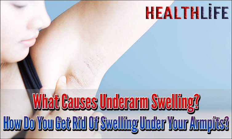 What Causes Underarm Swelling