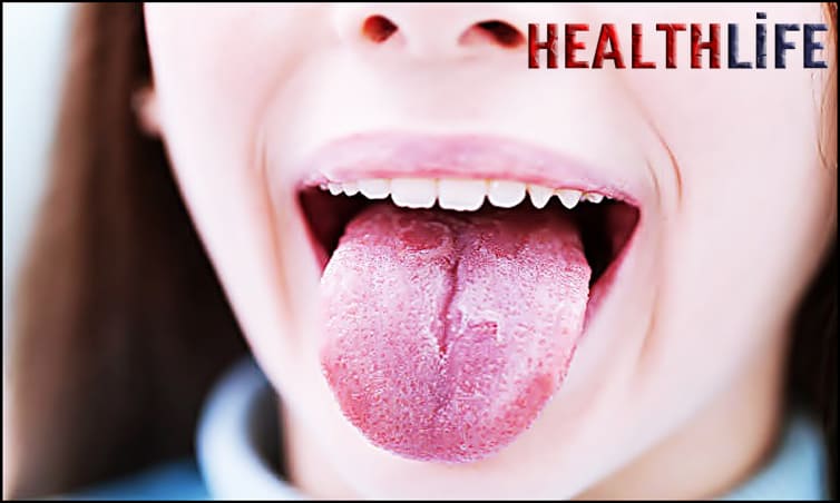 What Deficiency Can Cause A Sore Tongue