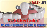 What Is A Hooked Denture