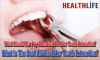 What Should You Pay Attention To After Tooth Extraction