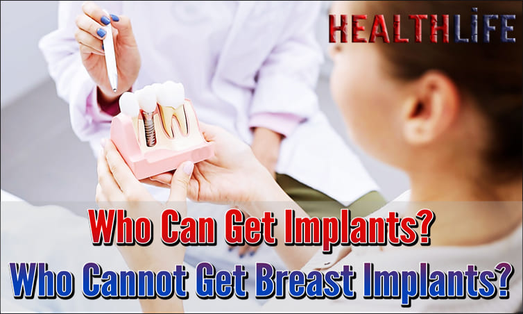Who Can Get Implants