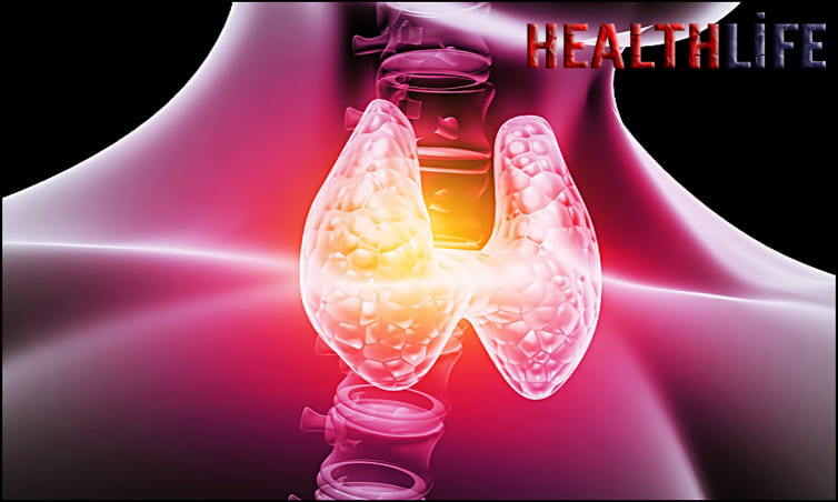 How Does Graves Disease Affect Everyday Life