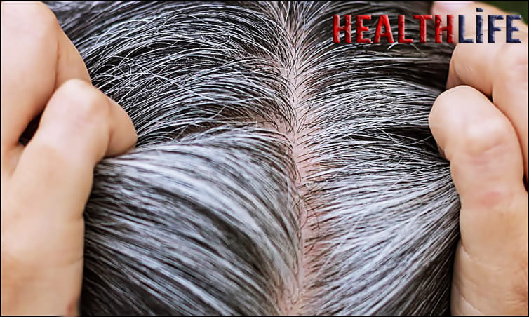How To Turn Grey Hair Black Naturally