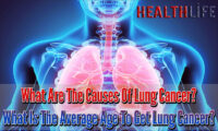 What Are The Causes Of Lung Cancer