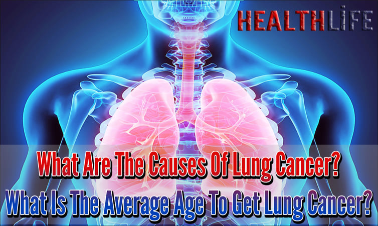 What Are The Causes Of Lung Cancer