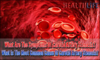 What Are The Symptoms Of Carotid Artery Stenosis