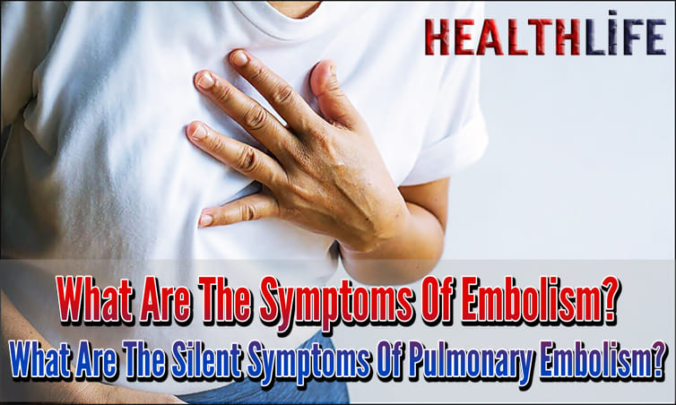 What Are The Symptoms Of Embolism